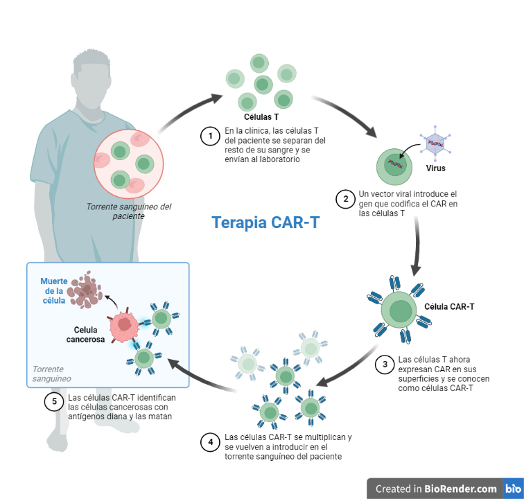 Esquema de todos los pasos de la teraia CAR-T